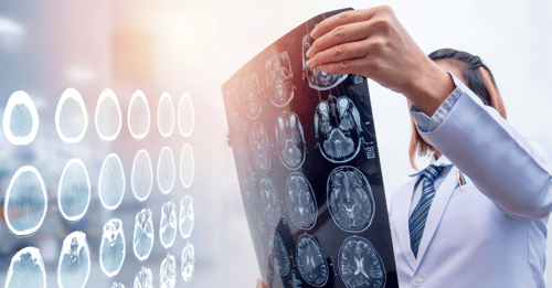 A doctor reviews imaging of traumatic brain injuries.